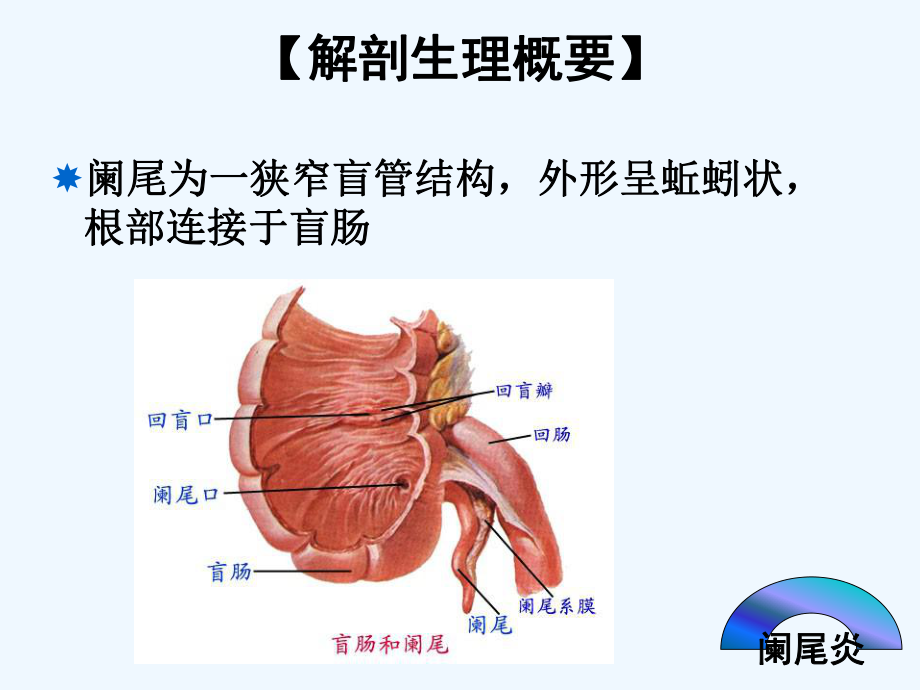 急性阑尾炎患者护理课件.ppt_第2页