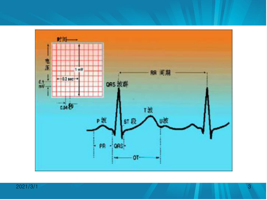 心电图讲座课件.ppt_第3页