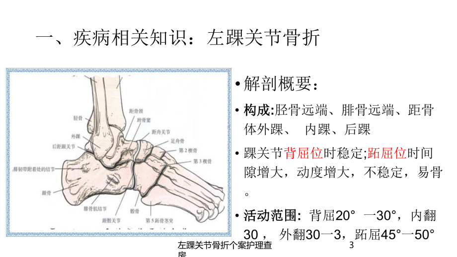 左踝关节骨折个案护理查房培训课件.ppt_第3页