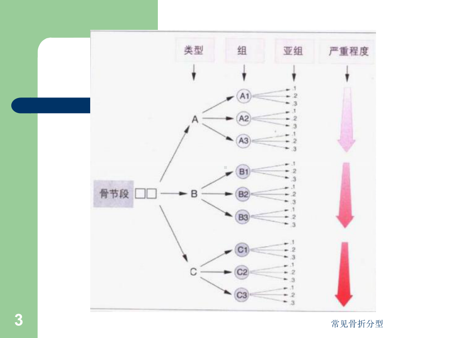 常见骨折分型培训课件.ppt_第3页