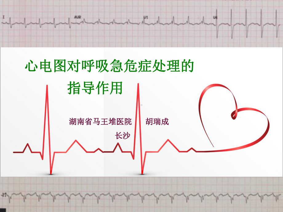 心电图对呼吸急危症处理的指导作用课件.ppt_第1页