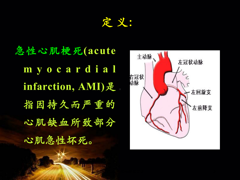 急性心肌梗死指南解读宣讲培训课件.ppt_第2页