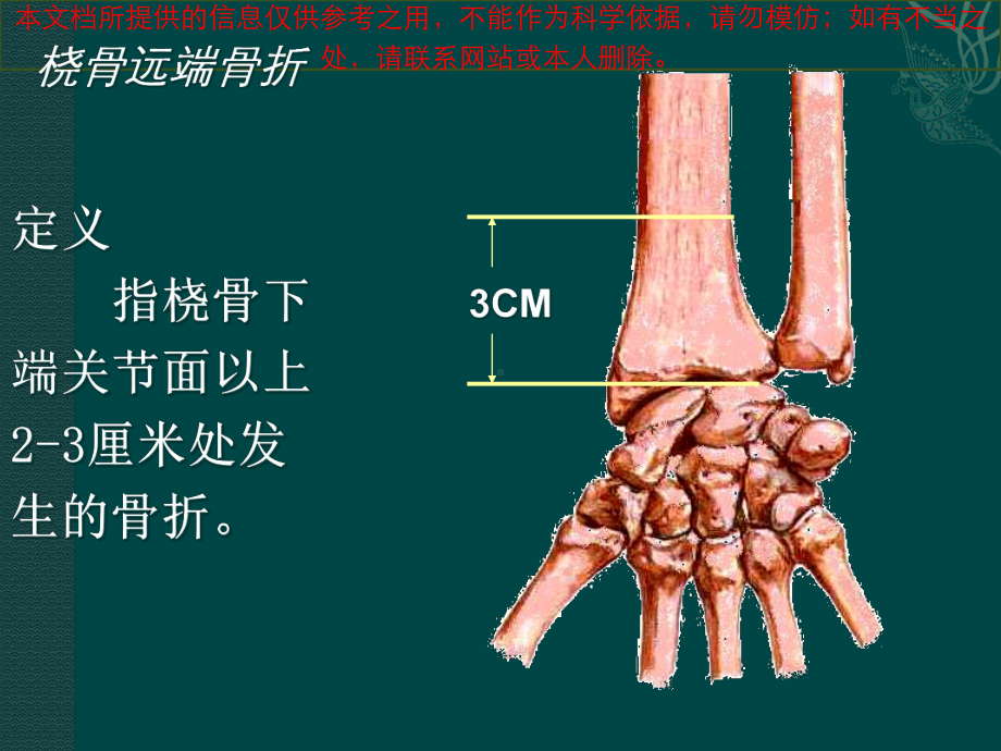 桡骨远端骨折汇总培训课件.ppt_第1页