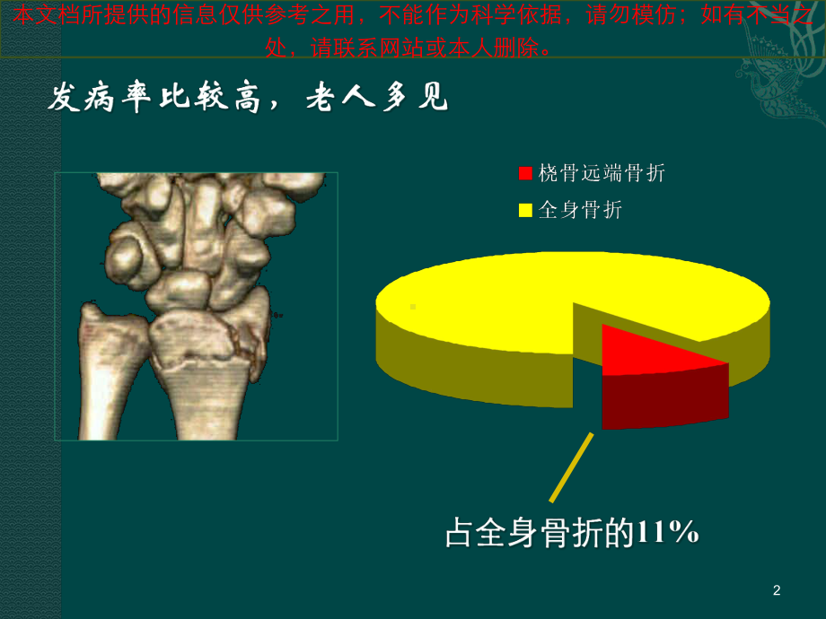 桡骨远端骨折汇总培训课件.ppt_第2页