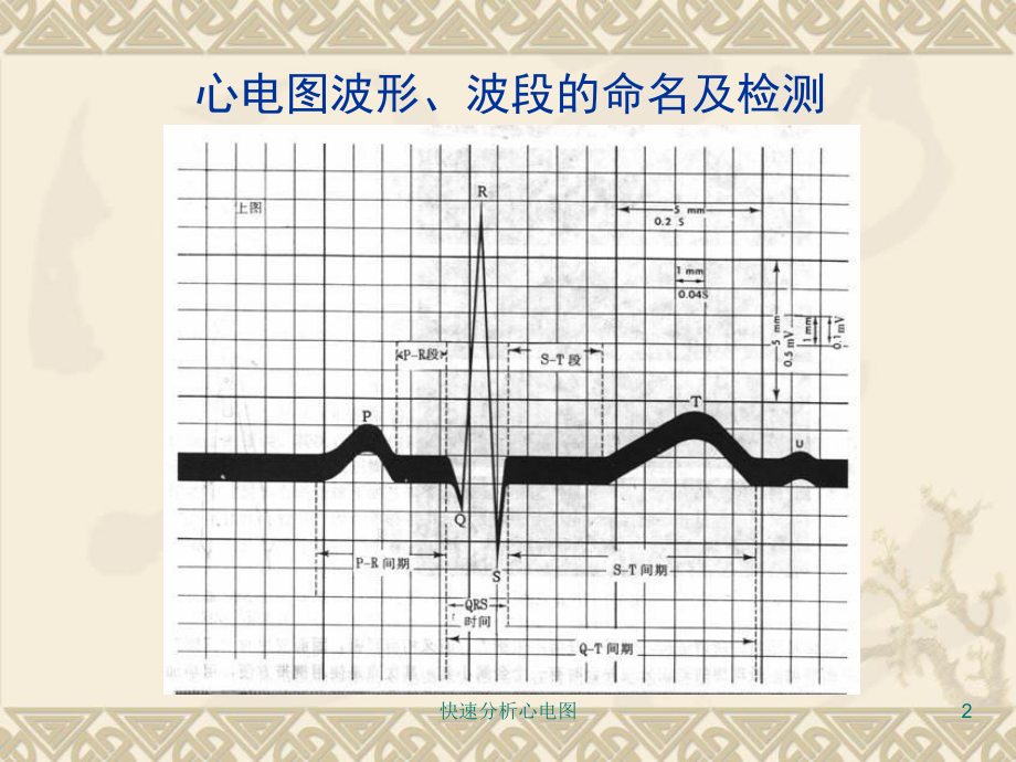 快速分析心电图培训课件.ppt_第2页