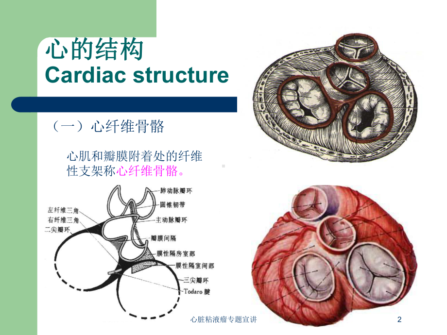 心脏粘液瘤专题宣讲培训课件.ppt_第2页