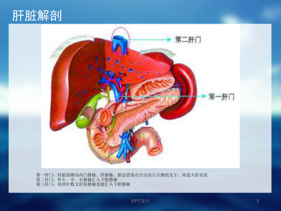 布加综合征-课件.ppt_第3页