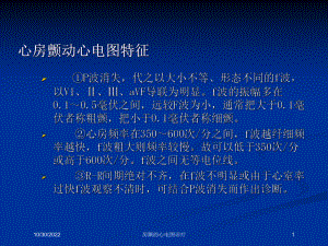 房颤的心电图诊疗培训课件.ppt