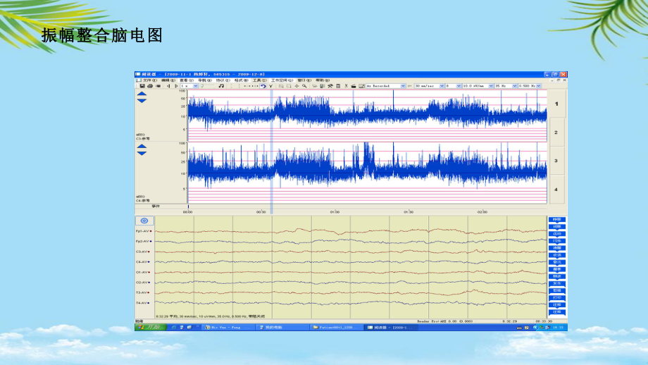 振幅整合脑电图在临床的应用全面课件.pptx_第3页