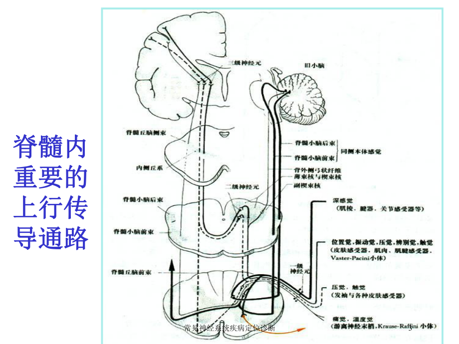 常见神经系统疾病定位诊断培训课件.ppt_第3页