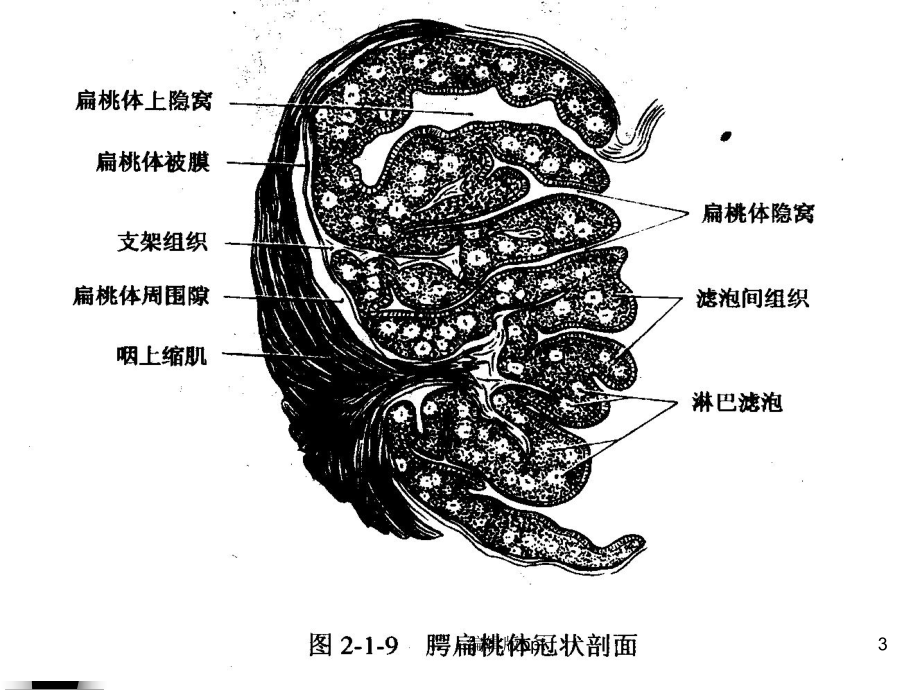 扁桃体炎鼻咽癌病人护理课件.ppt_第3页