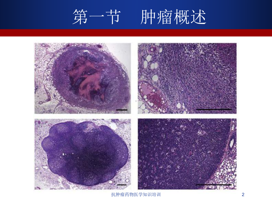 抗肿瘤药物医学知识培训培训课件.ppt_第2页