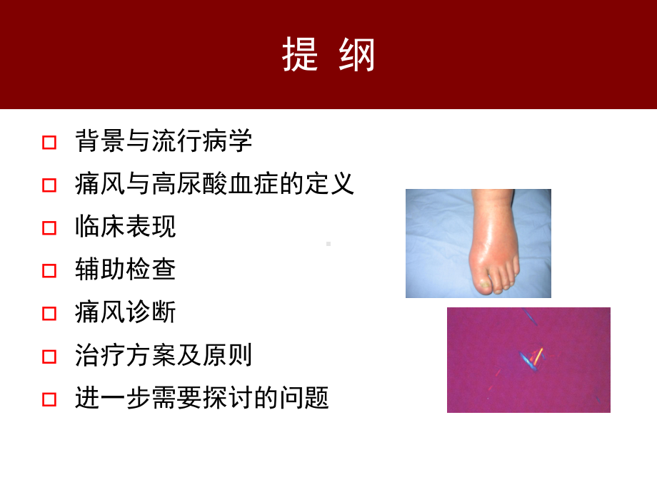 我国痛风临床诊治指南解读培训课件.ppt_第1页