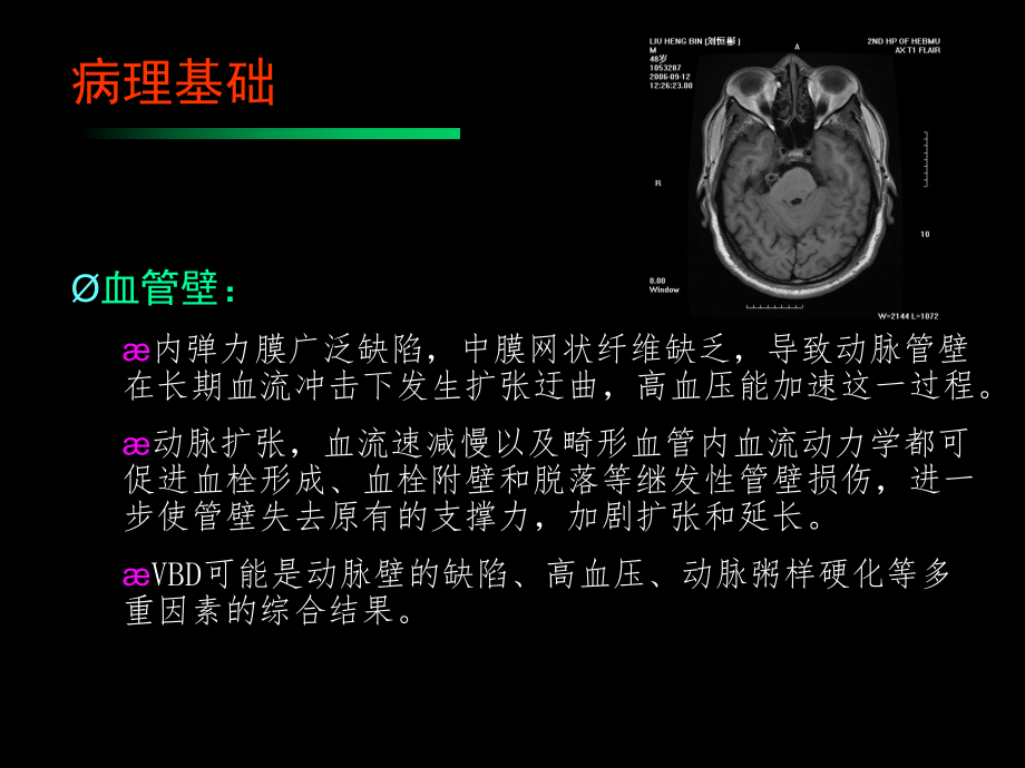 椎基底动脉扩张延长症教材课件.ppt_第3页