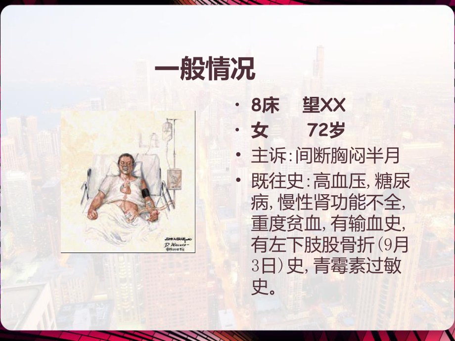 心绞痛护理查房-课件.pptx_第2页