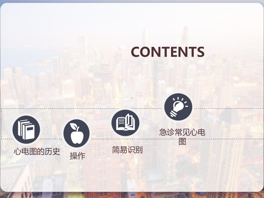 急诊科常见心电图识别-课件.ppt_第2页