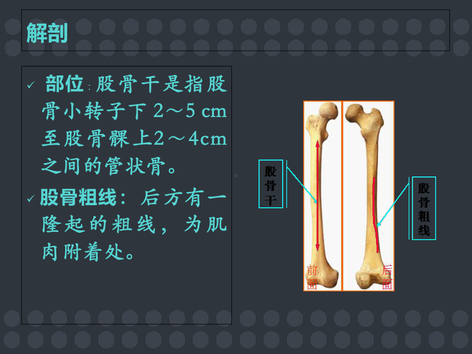 悬吊牵引治疗小儿股骨干骨折课件.ppt_第3页