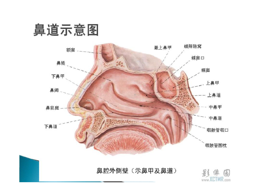 支气管镜检查顺序课件.ppt_第3页