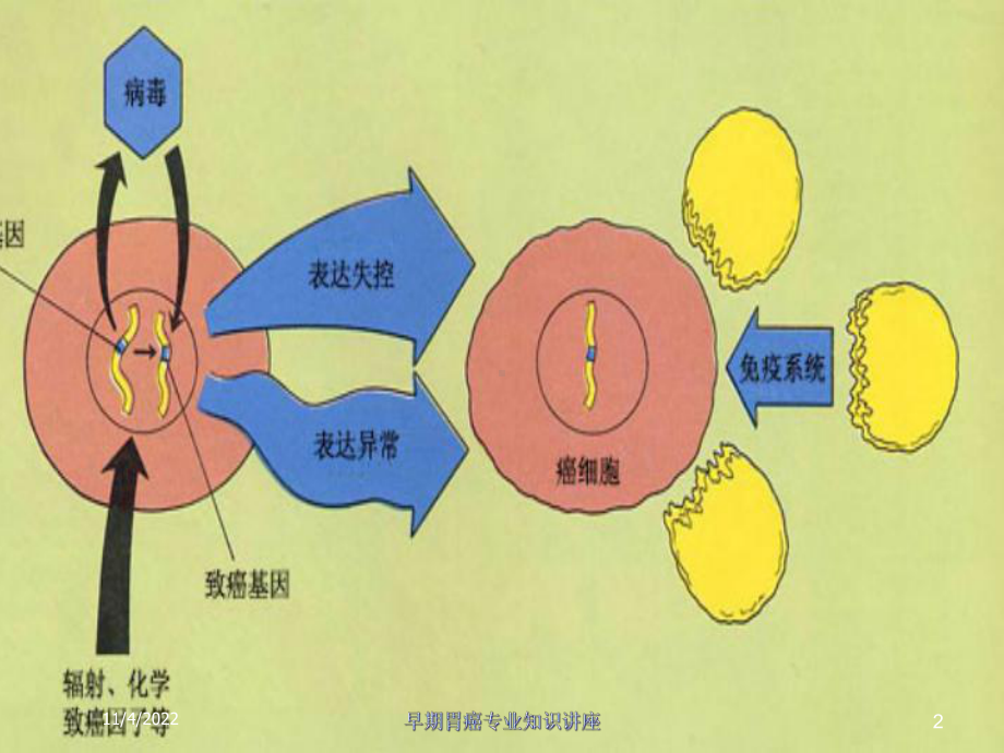 早期胃癌专业知识讲座培训课件.ppt_第2页