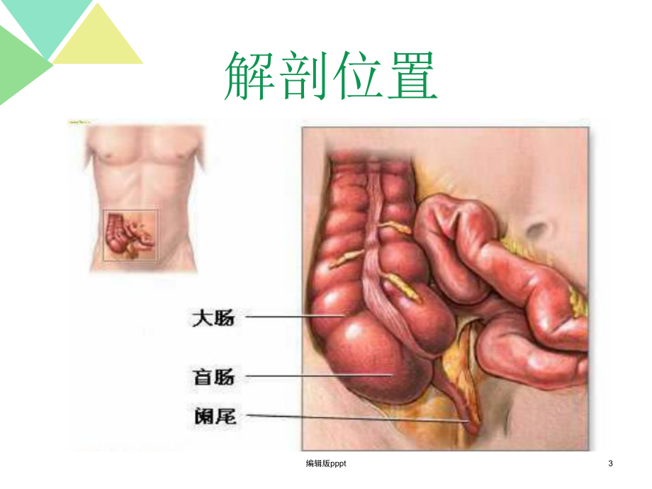 急性阑尾炎术后的护理课件.ppt_第3页