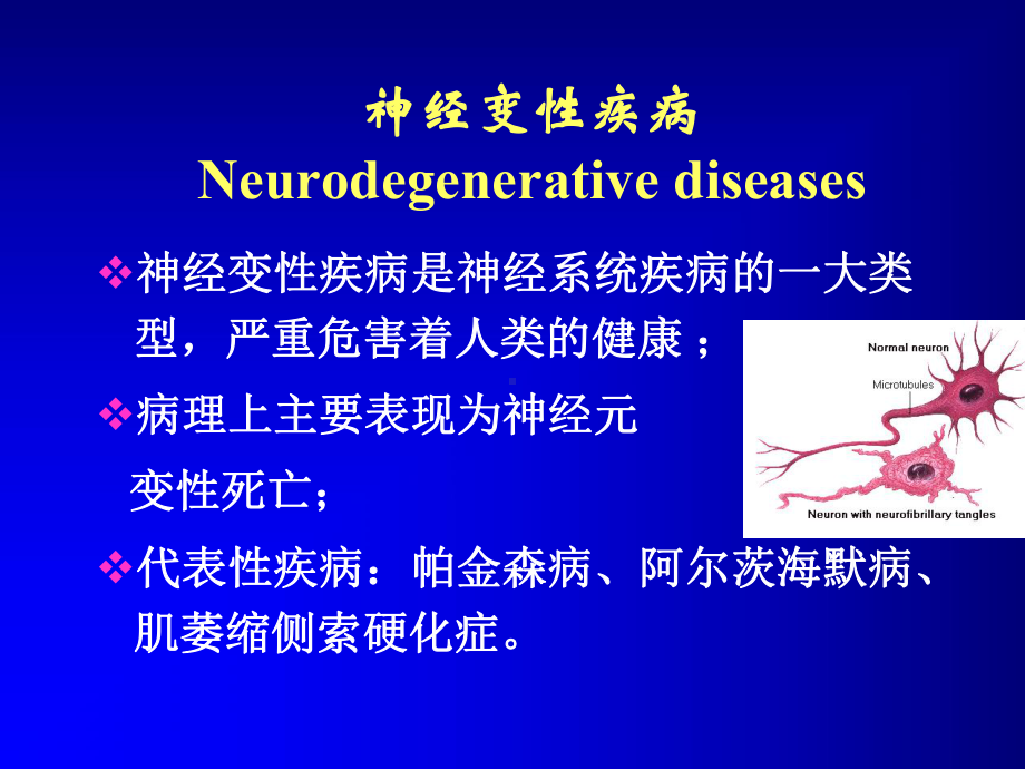 帕金森病课件.pptx_第2页