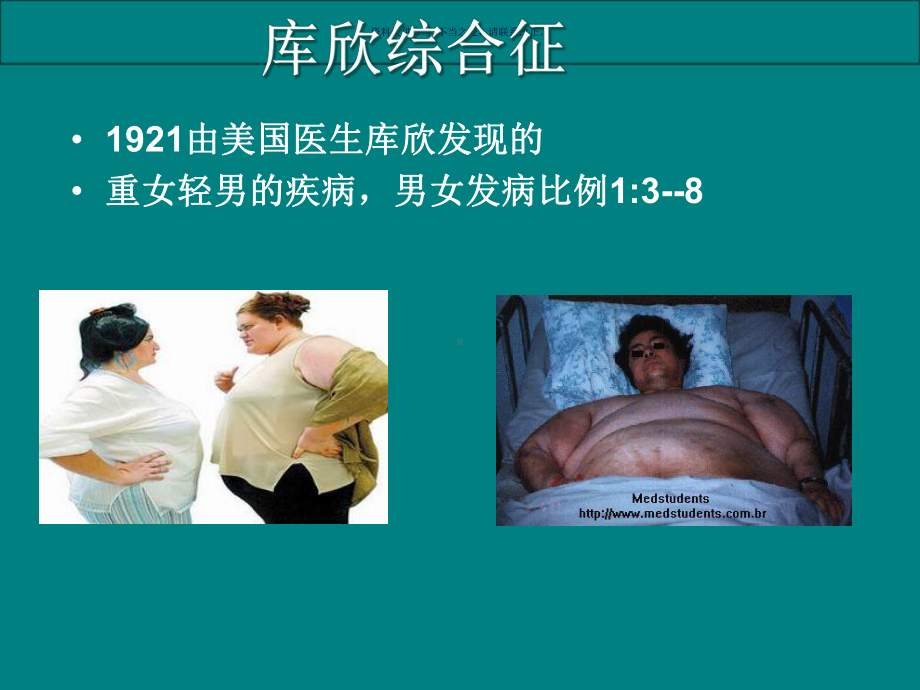 库欣综合征医学宣教课件.ppt_第1页