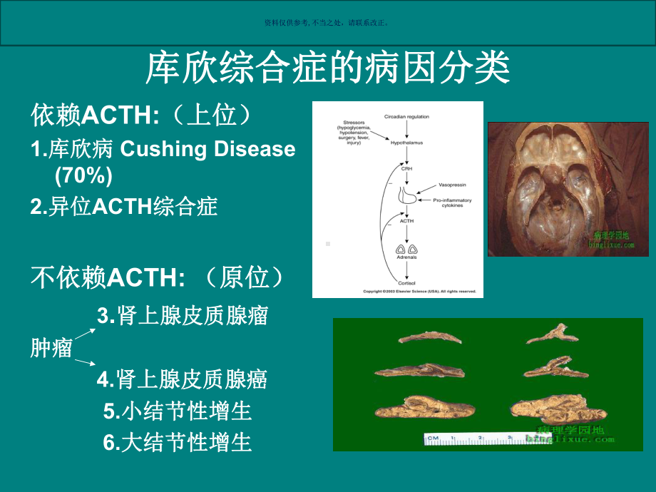 库欣综合征医学宣教课件.ppt_第3页