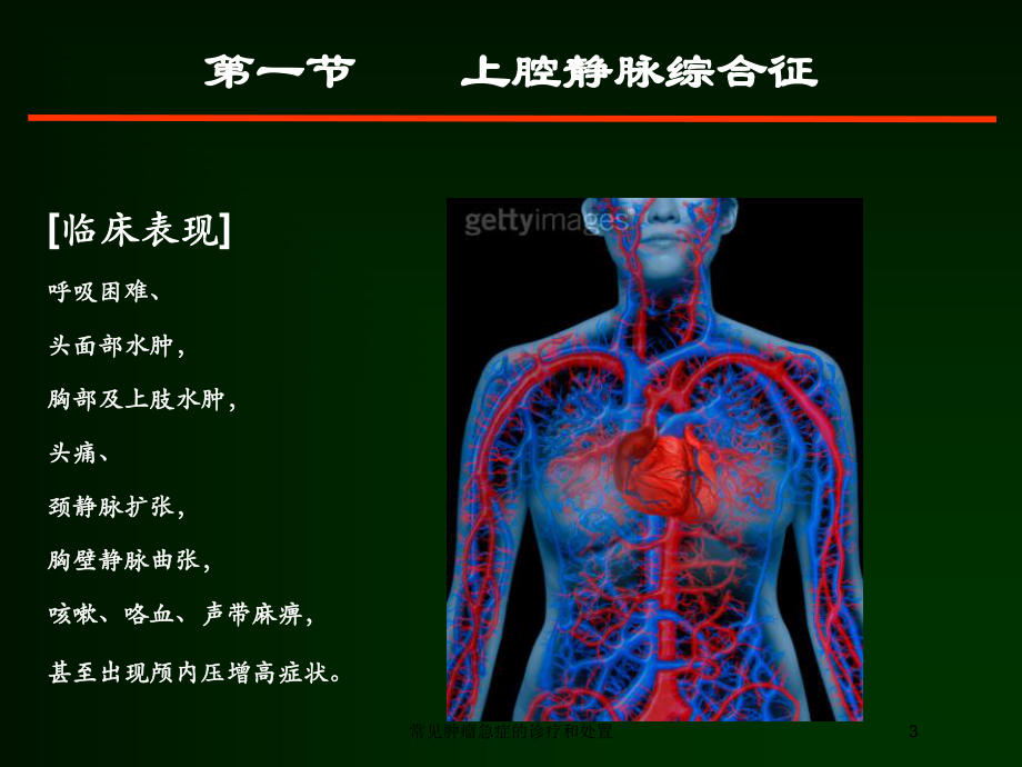 常见肿瘤急症的诊疗和处置培训课件.ppt_第3页