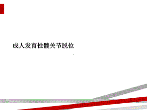 成人发育性髋关节脱位课件.ppt