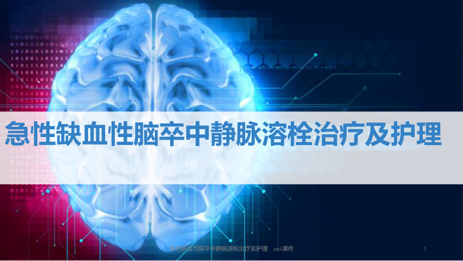 急性缺血性脑卒中静脉溶栓治疗及护理-课件.ppt_第1页