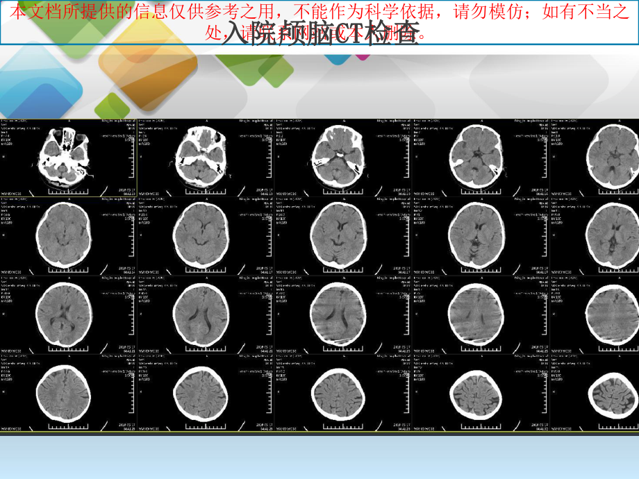 急性脑梗死动脉取栓治疗培训课件.ppt_第2页