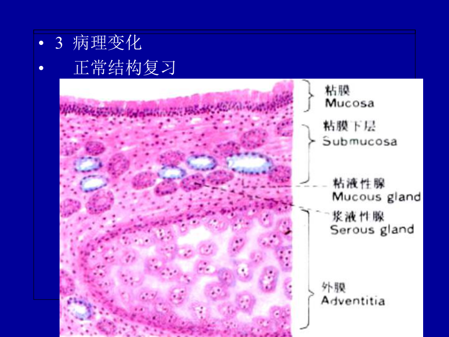 慢支炎—呼肿病理学课件.ppt_第2页