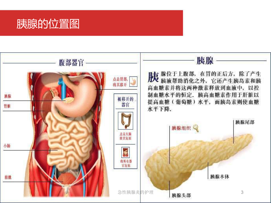 急性胰腺炎的护理培训课件.ppt_第3页