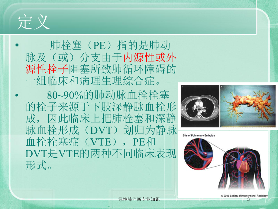 急性肺栓塞专业知识培训课件.ppt_第3页