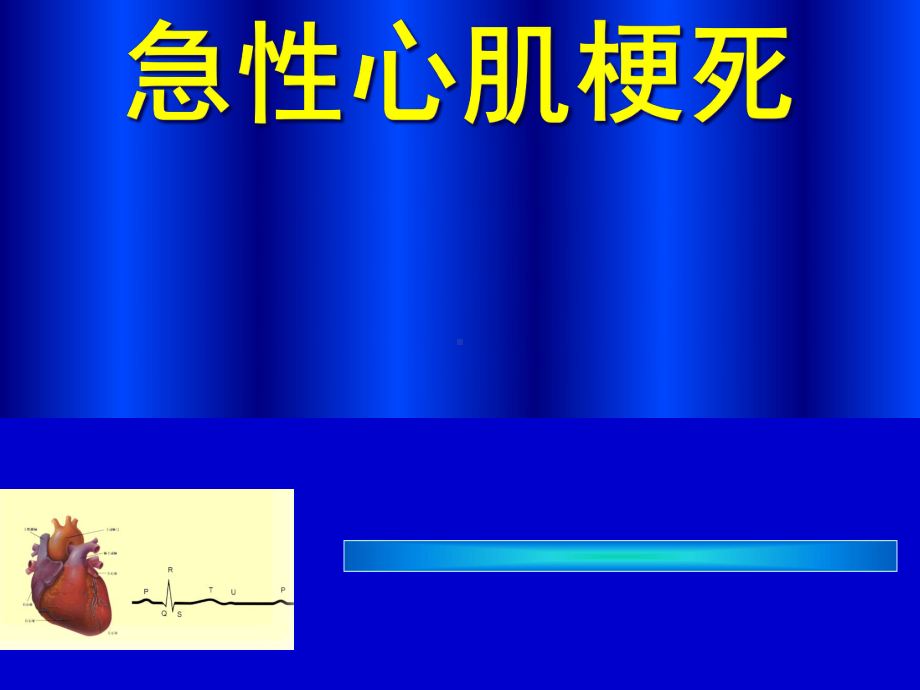 急性心肌梗死课件-2.ppt_第1页
