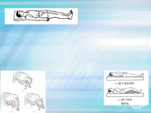 手术卧位-仰卧位课件.pptx