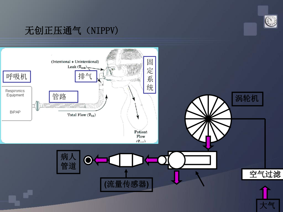 无创呼吸机组成说课讲解课件.ppt_第3页