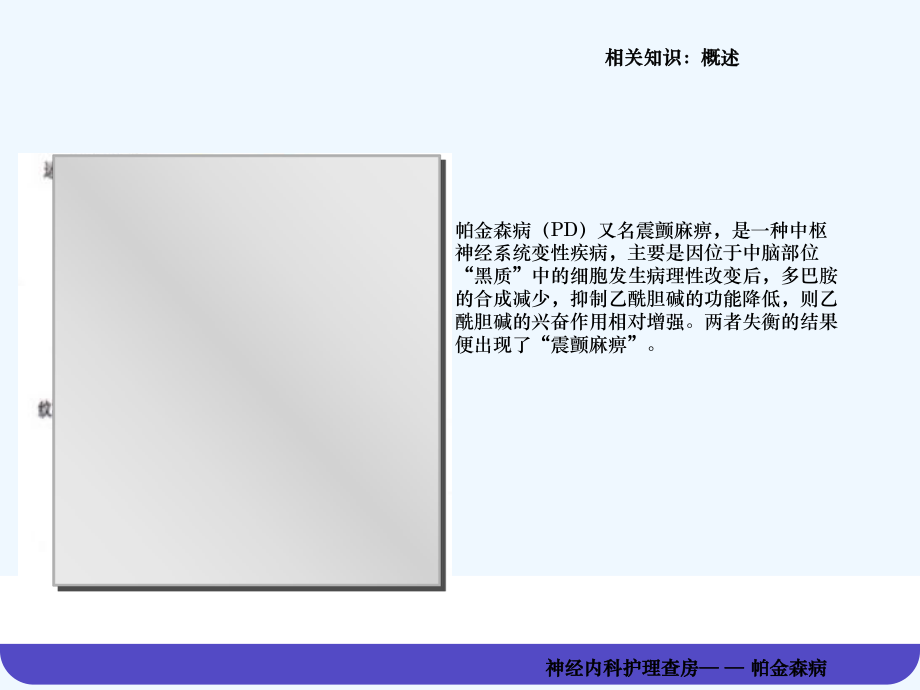 帕金森神经内科护理查房课件.ppt_第3页
