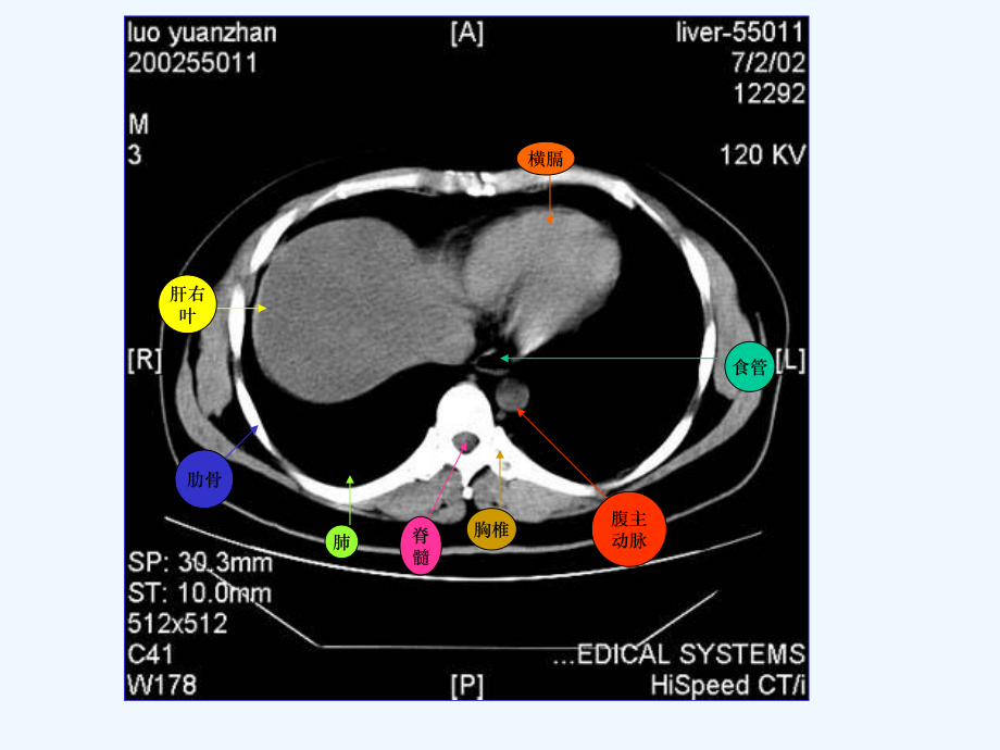 普外科必看腹部CT课件.ppt_第1页