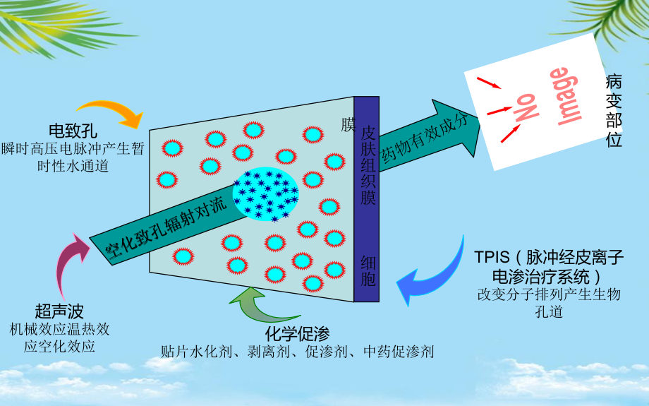 教培用超声药物透入疗法对临床常见痛症的治疗课件.pptx_第3页