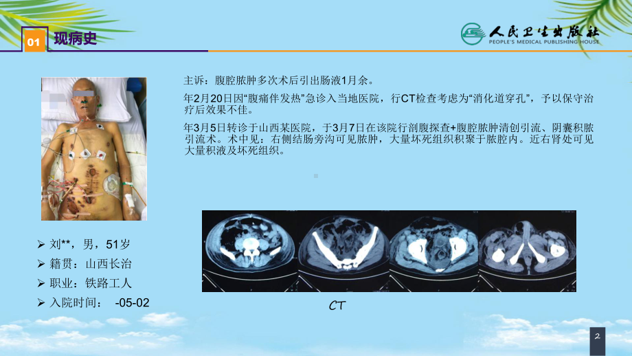 案例分析肠瘘腹腔感染合并脓毒症全面课件.pptx_第2页