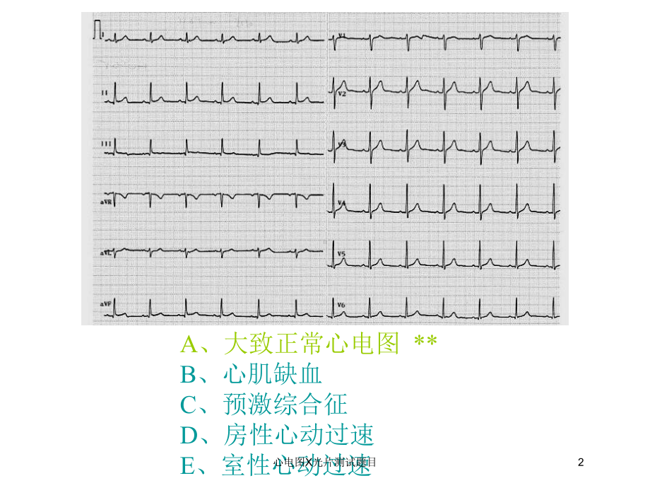 心电图X光片测试题目培训课件.ppt_第2页