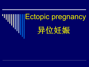 异位妊娠段钊课件.pptx