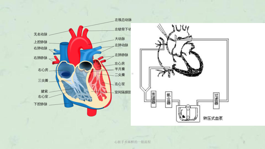 心脏手术麻醉的一般流程课件.ppt_第2页