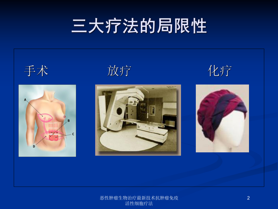 恶性肿瘤生物治疗技术抗肿瘤免疫活性细胞疗法培训课件.ppt_第2页