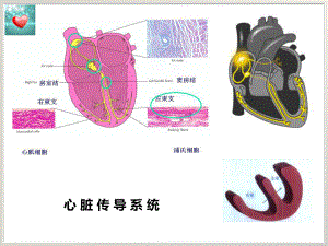 左束支传导阻滞和急性心肌梗死培训课件.ppt