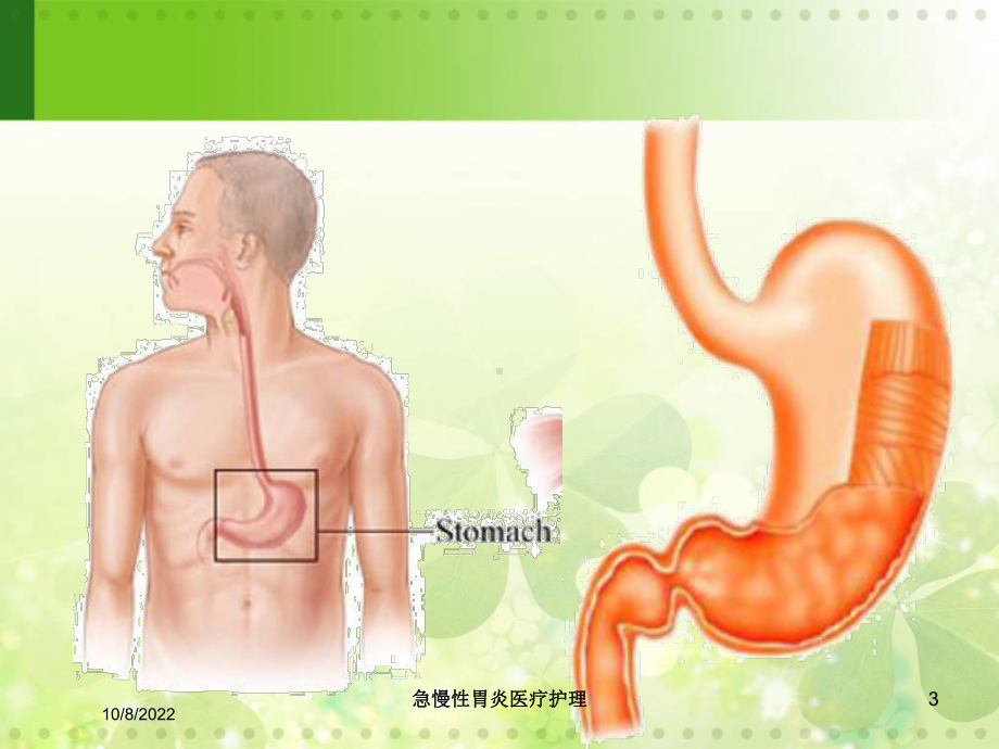 急慢性胃炎医疗护理培训课件.ppt_第3页