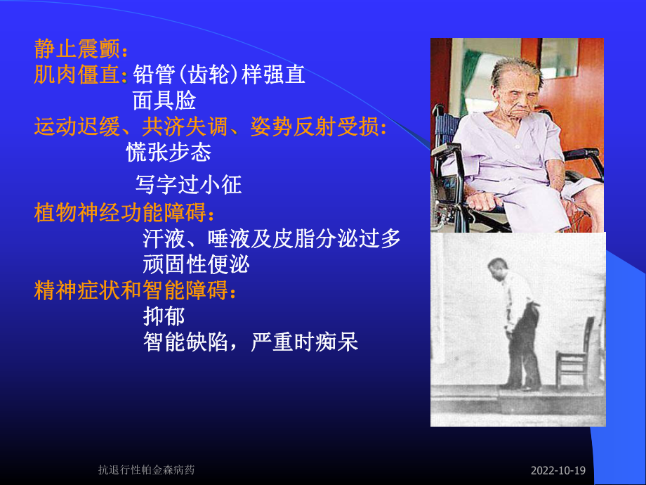 抗退行性帕金森病药课件.ppt_第2页