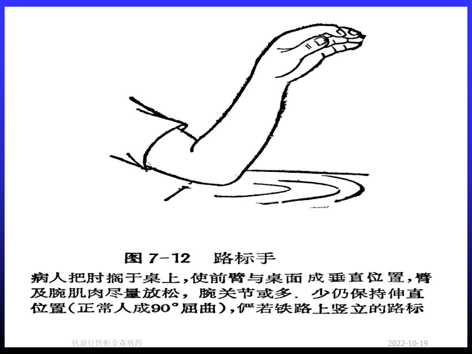 抗退行性帕金森病药课件.ppt_第3页