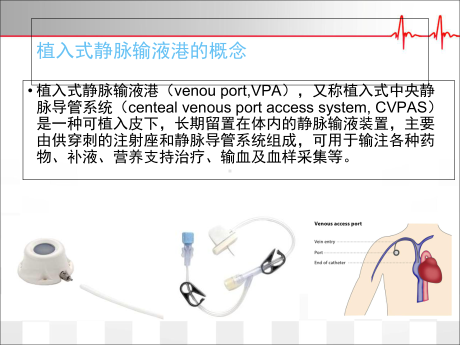 植入式静脉输液港的临床应用学习课件.ppt_第3页